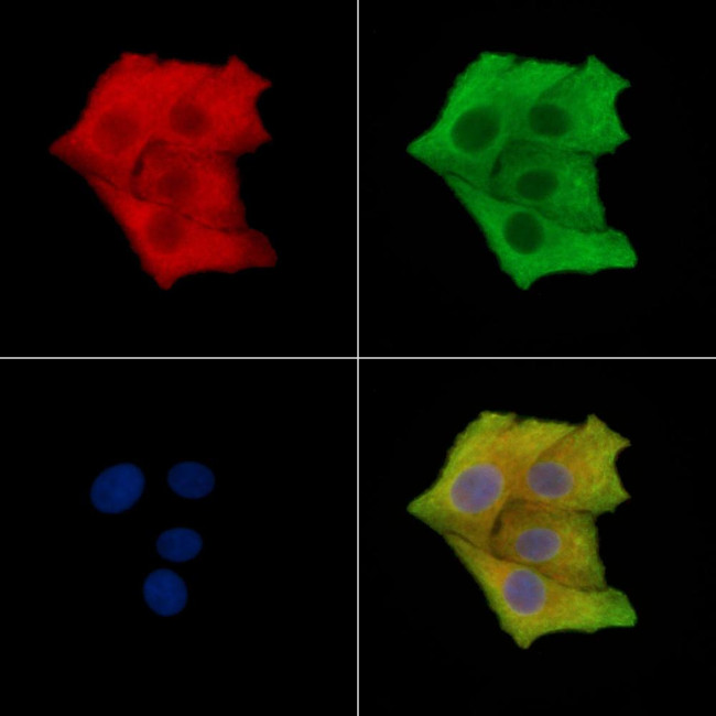 Phospho-DOK2 (Tyr139) Antibody in Immunocytochemistry (ICC/IF)