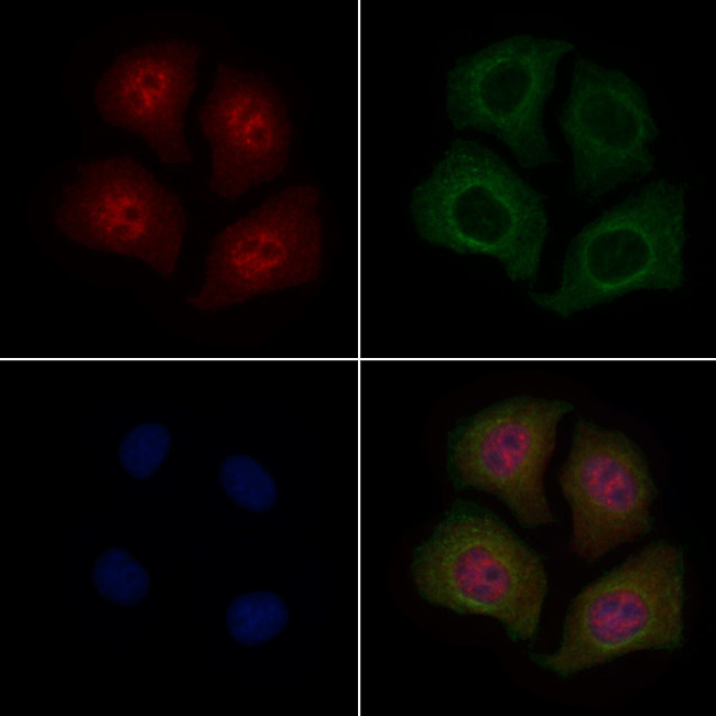 Phospho-HDAC7 (Ser486) Antibody in Immunocytochemistry (ICC/IF)