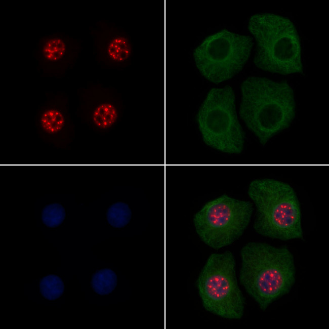 Phospho-p130 (Thr642) Antibody in Immunocytochemistry (ICC/IF)