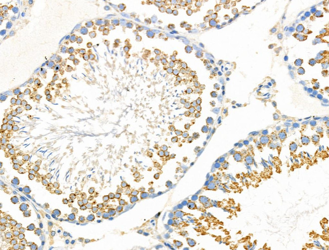 Phospho-EphA2 (Tyr930) Antibody in Immunohistochemistry (Paraffin) (IHC (P))