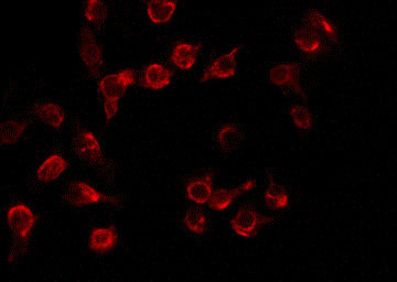 Phospho-LAT (Tyr255) Antibody in Immunocytochemistry (ICC/IF)