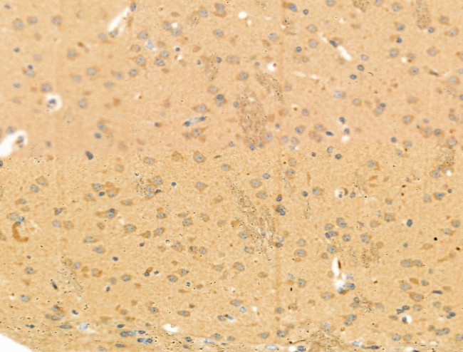 Phospho-ALK (Tyr1078) Antibody in Immunohistochemistry (Paraffin) (IHC (P))