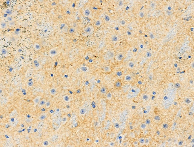 Phospho-AP2M1 (Thr156) Antibody in Immunohistochemistry (Paraffin) (IHC (P))