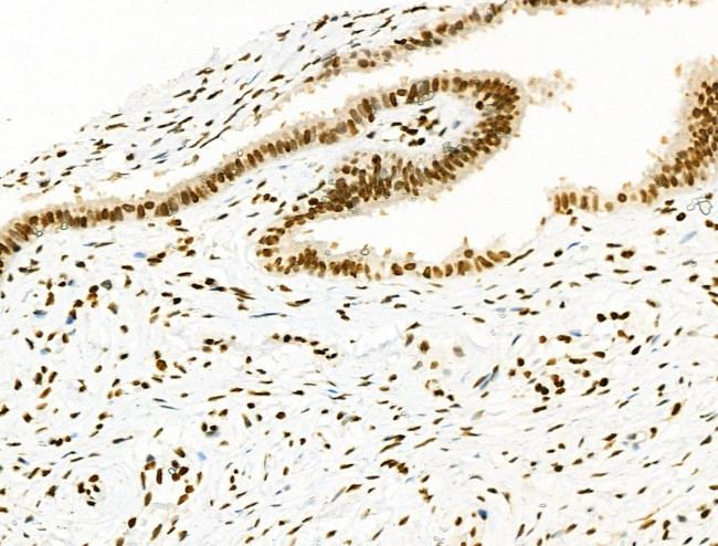 Phospho-SMC3 (Ser1067) Antibody in Immunohistochemistry (Paraffin) (IHC (P))