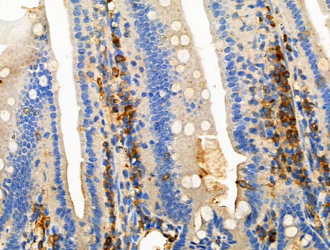 Phospho-CD19 (Tyr500) Antibody in Immunohistochemistry (Paraffin) (IHC (P))