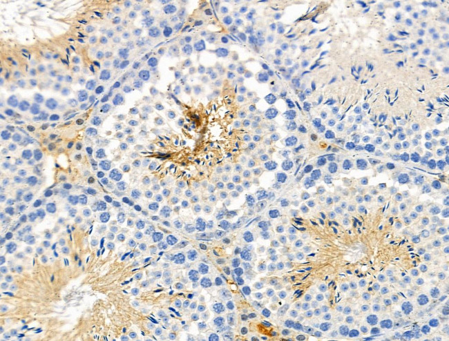 Phospho-eIF2 beta (Ser67) Antibody in Immunohistochemistry (Paraffin) (IHC (P))