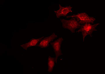 Phospho-FANCD2 (Ser717) Antibody in Immunocytochemistry (ICC/IF)