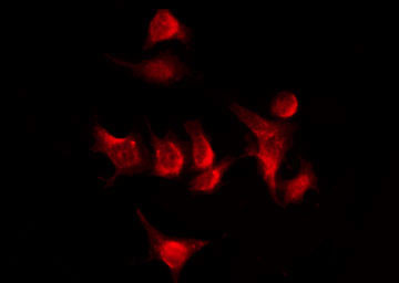 Phospho-FANCD2 (Thr691) Antibody in Immunocytochemistry (ICC/IF)