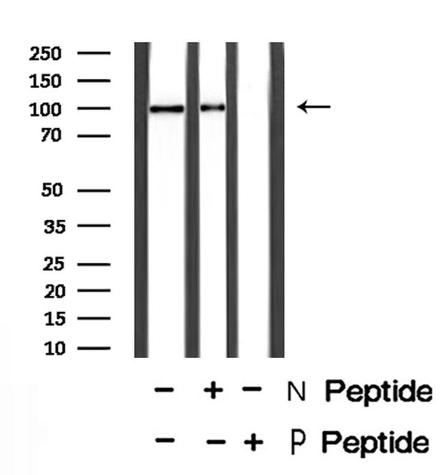 Phospho-HSP105 (Ser809) Antibody in Western Blot (WB)