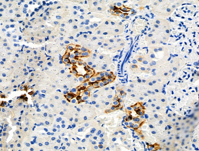 Phospho-NHE3 (Ser555) Antibody in Immunohistochemistry (Paraffin) (IHC (P))