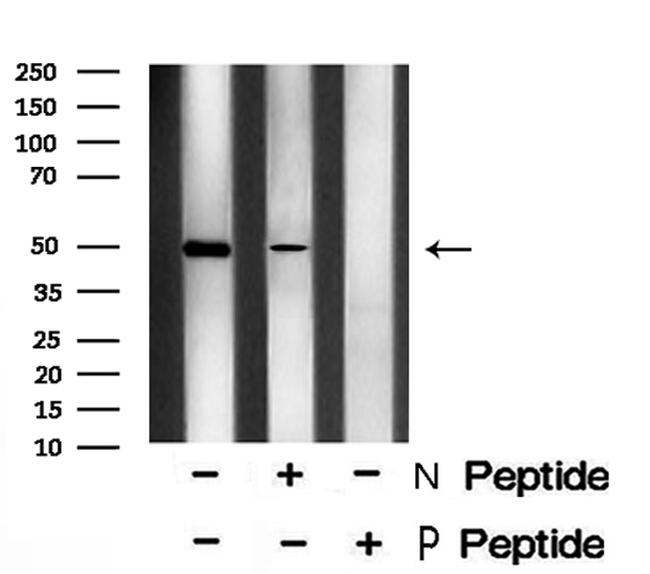 Phospho-YBX1 (Ser102) Antibody in Western Blot (WB)