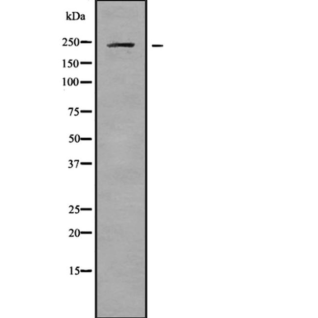 CaV1.3 Antibody in Western Blot (WB)