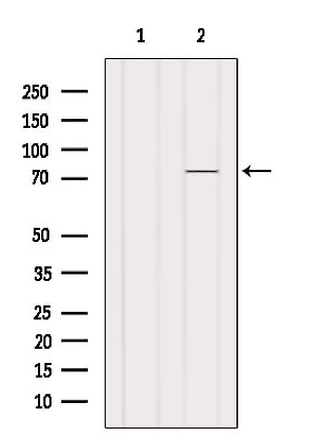 ZDHHC17 Antibody in Western Blot (WB)