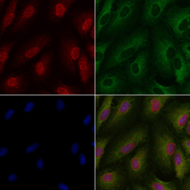 PKC lambda/iota Antibody in Immunocytochemistry (ICC/IF)