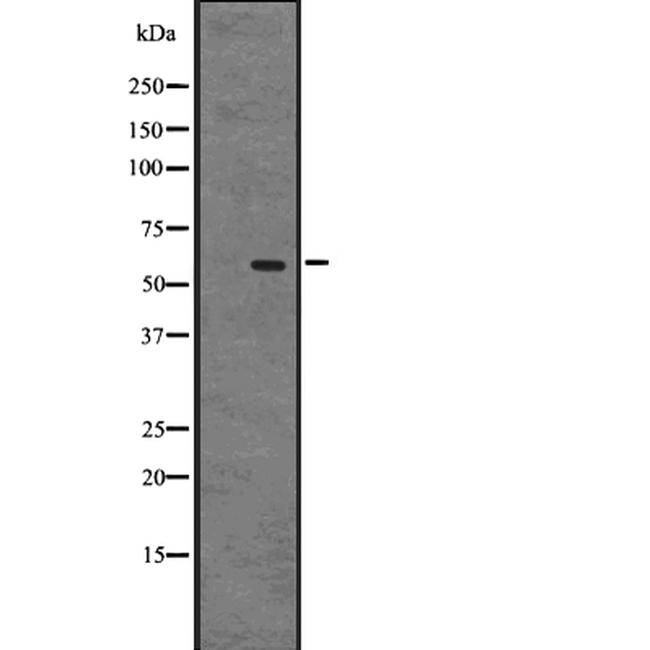 GPR75 Antibody in Western Blot (WB)