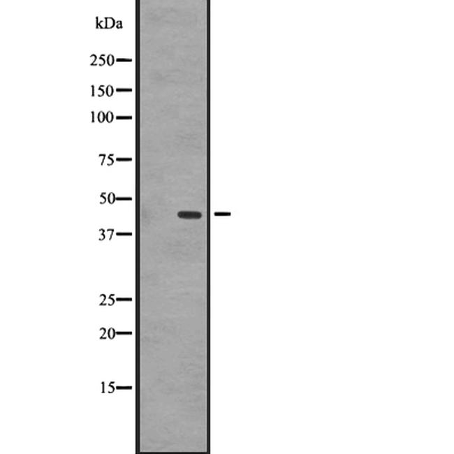 GPR87 Antibody in Western Blot (WB)