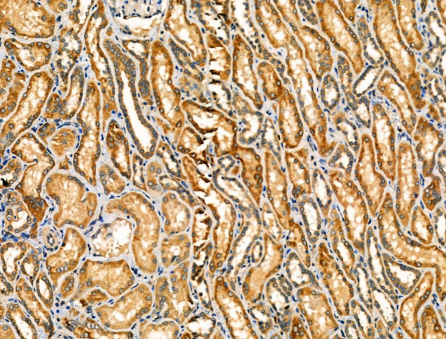 PRKCSH Antibody in Immunohistochemistry (Paraffin) (IHC (P))