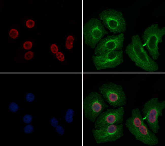 CRP1 Antibody in Immunocytochemistry (ICC/IF)