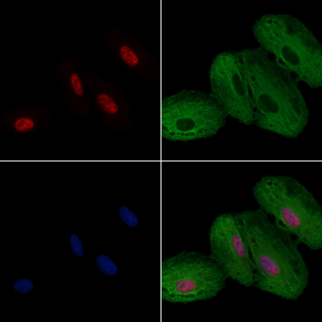 hnRNP F Antibody in Immunocytochemistry (ICC/IF)