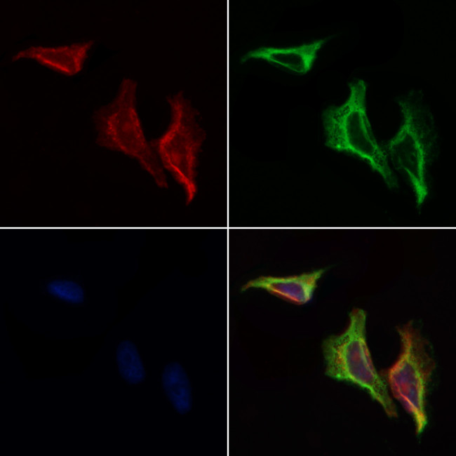 GIT2 Antibody in Immunocytochemistry (ICC/IF)