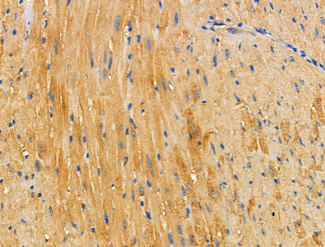 DOK4 Antibody in Immunohistochemistry (Paraffin) (IHC (P))