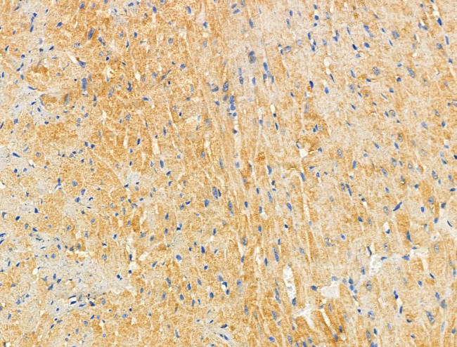 SLK Antibody in Immunohistochemistry (Paraffin) (IHC (P))