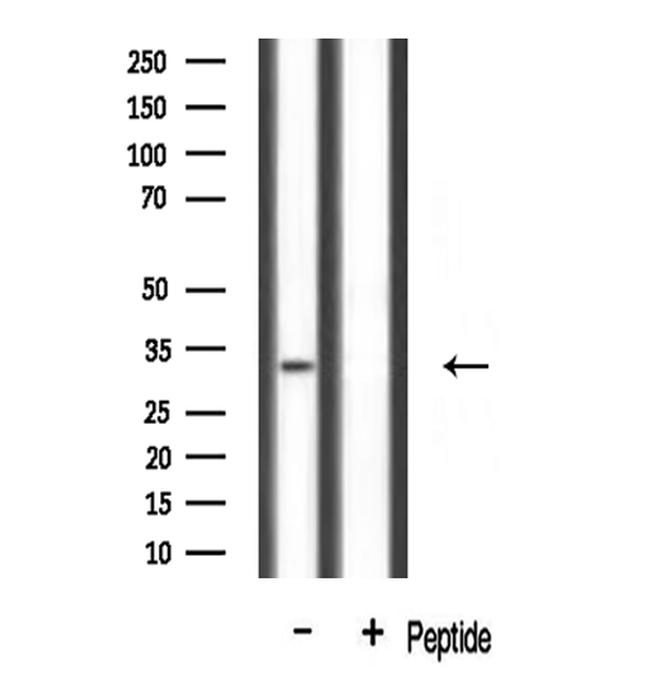 MLX Antibody in Western Blot (WB)