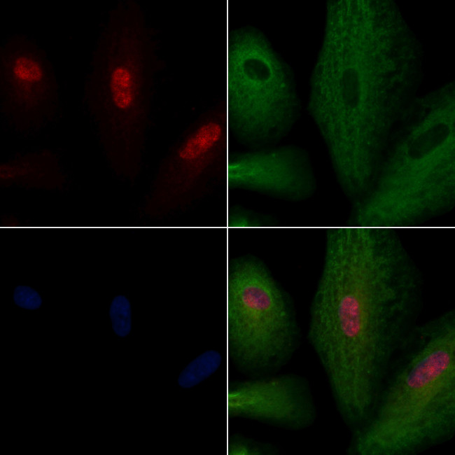 ASF1A Antibody in Immunocytochemistry (ICC/IF)