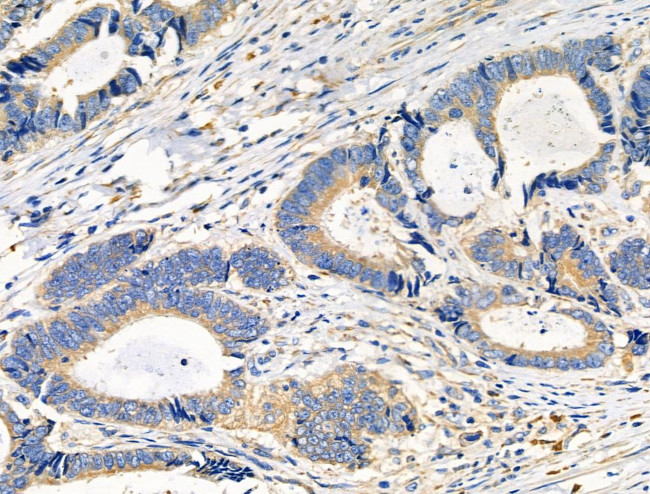 RPS4X Antibody in Immunohistochemistry (Paraffin) (IHC (P))