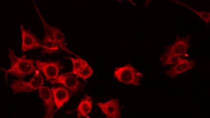 ACOT8 Antibody in Immunocytochemistry (ICC/IF)