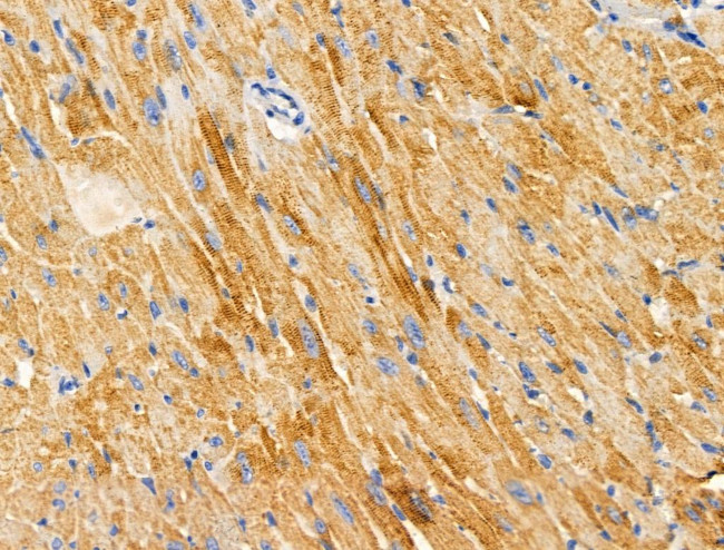 Arfaptin 1 Antibody in Immunohistochemistry (Paraffin) (IHC (P))