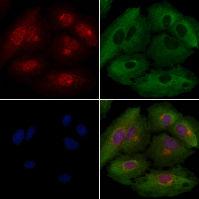 Calponin 2 Antibody in Immunocytochemistry (ICC/IF)