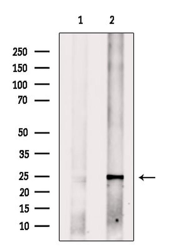 MED18 Antibody in Western Blot (WB)