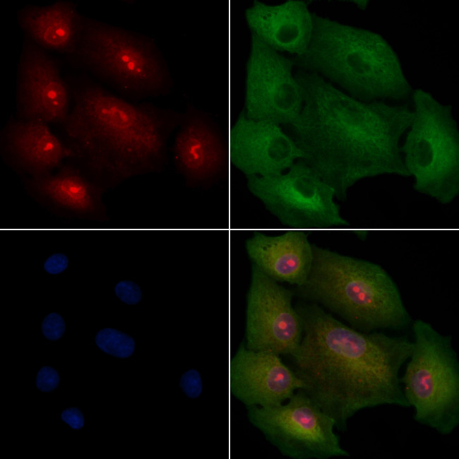 MED8 Antibody in Immunocytochemistry (ICC/IF)