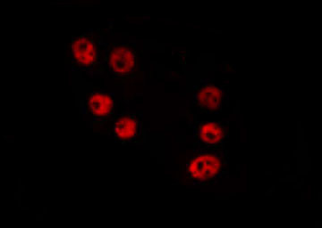 HELZ2 Antibody in Immunocytochemistry (ICC/IF)