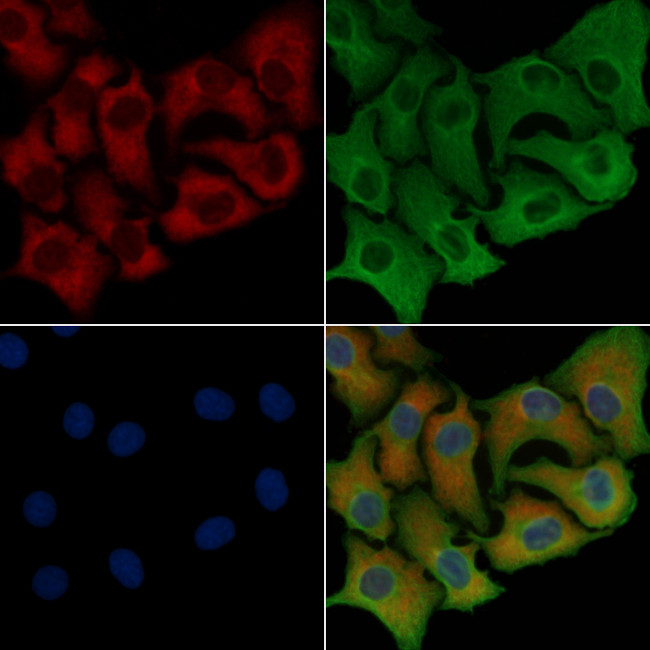 GIPR Antibody in Immunocytochemistry (ICC/IF)
