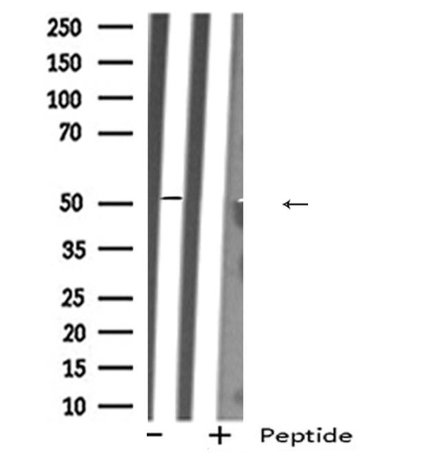 MAOA Antibody in Western Blot (WB)