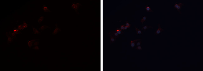 Perilipin 1 Antibody in Immunocytochemistry (ICC/IF)