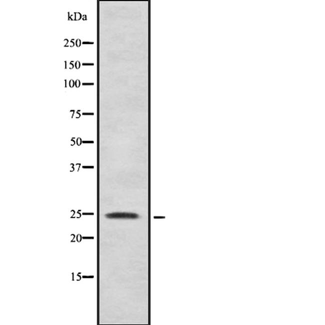GSTK1 Antibody in Western Blot (WB)
