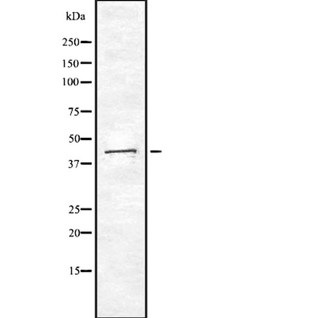 Creatine Kinase BB Antibody in Western Blot (WB)