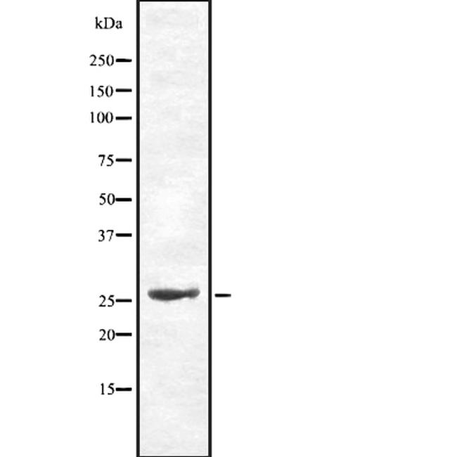 Cdc34 Antibody in Western Blot (WB)