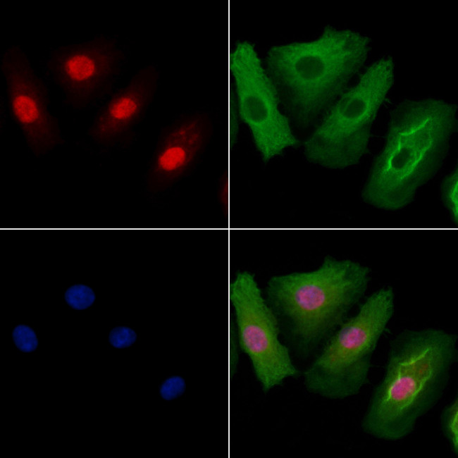 ELF5 Antibody in Immunocytochemistry (ICC/IF)