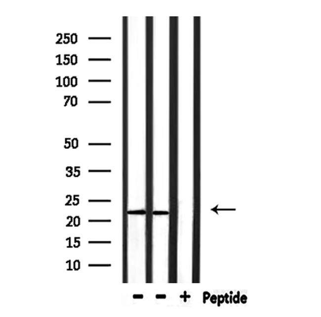RPL14 Antibody in Western Blot (WB)