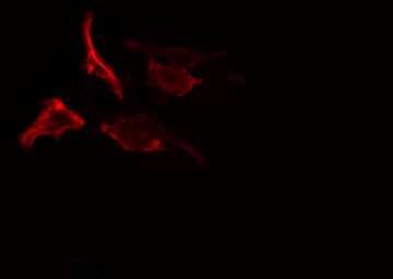 Phospho-RSK Pan (Ser221, Ser227, Ser218, Ser232) Antibody in Immunocytochemistry (ICC/IF)