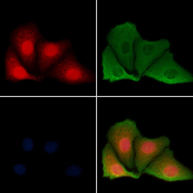 HMGN1 Antibody in Immunocytochemistry (ICC/IF)