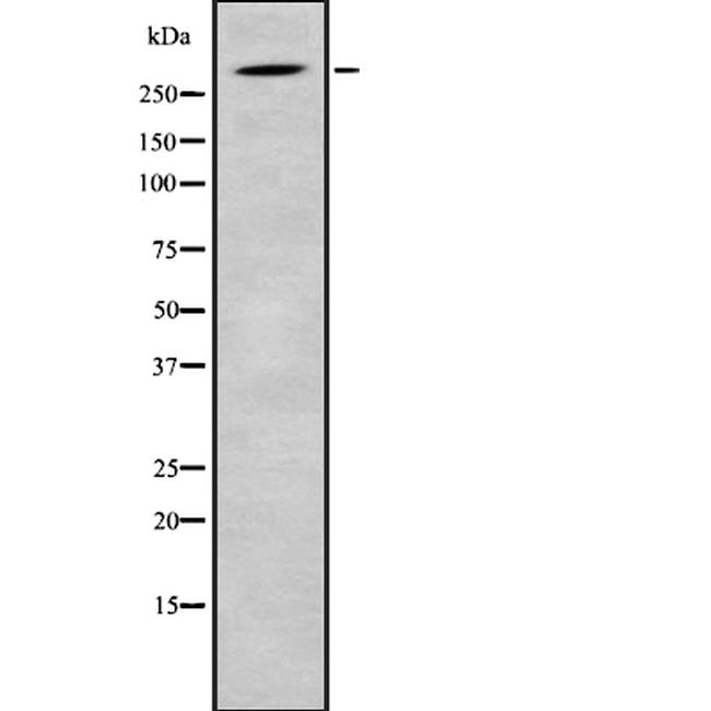 SRRM2 Antibody in Western Blot (WB)