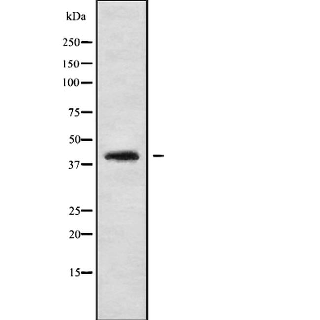 CABP1 Antibody in Western Blot (WB)