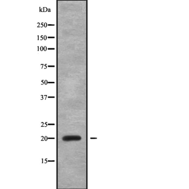 CABP5 Antibody in Western Blot (WB)