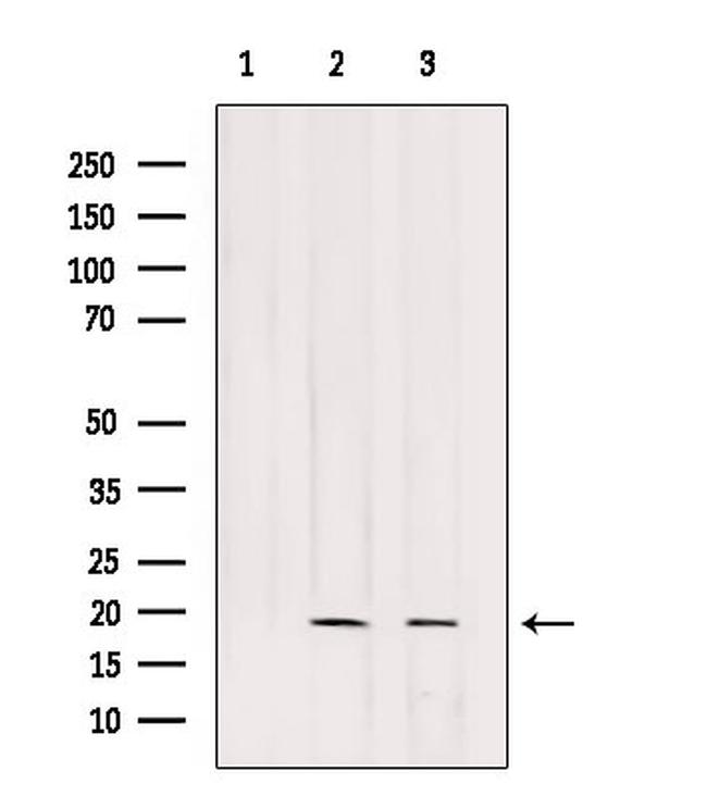 POLR2G Antibody in Western Blot (WB)