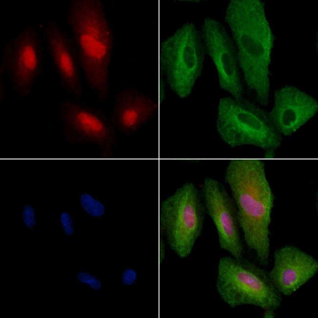 ARHGAP25 Antibody in Immunocytochemistry (ICC/IF)